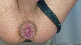 Ein gedehnter Anus gibt den Blick auf einen Hämorrhoidenvorfall frei, der durch das Reiten auf einer riesigen Flasche entstanden ist. Unglaubliches Hardcore-Fisting zu Hause.